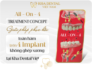 KHÔNG CHỈ CÓ ƯU ĐÃI ĐẾN 1O TRIỆU Invisalign TEEN: Hiểu đúng – an toàn – hiệu quả