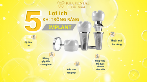 CẤY GHÉP IMPLANT – GIẢI PHÁP HOÀN HẢO CHO NGƯỜI MẤT RĂNG