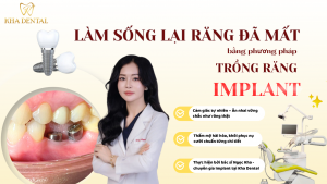 Răng sứ Lava – Lựa chọn của người đàn ông thành đạt