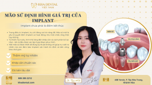 QUY TRÌNH CẤY GHÉP IMPLANT CHUẨN Y KHOA – HÀNH TRÌNH NỤ CƯỜI BẮT ĐẦU TỪ SỰ TẬN TÂM